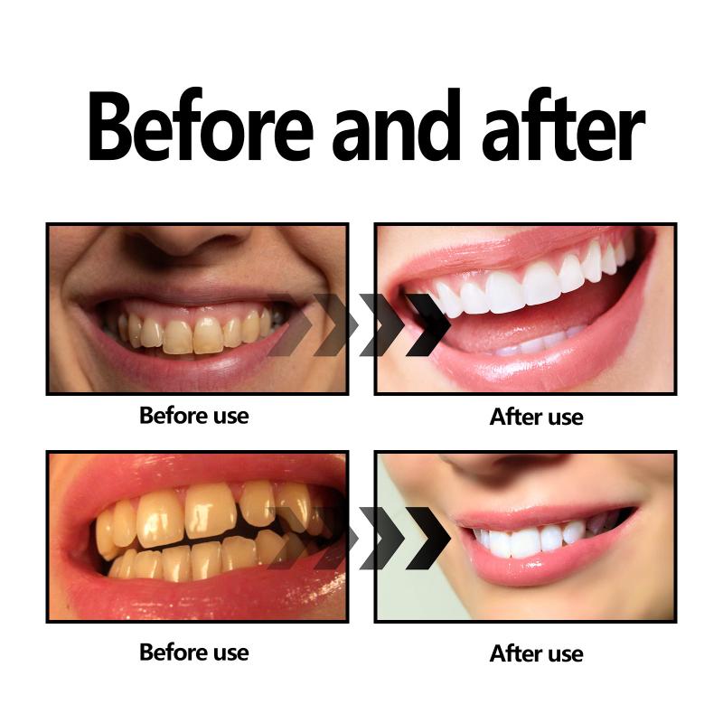 Bamboo Charcoal Powder Teeth N - Teeth Whitening Filter 评论和价格