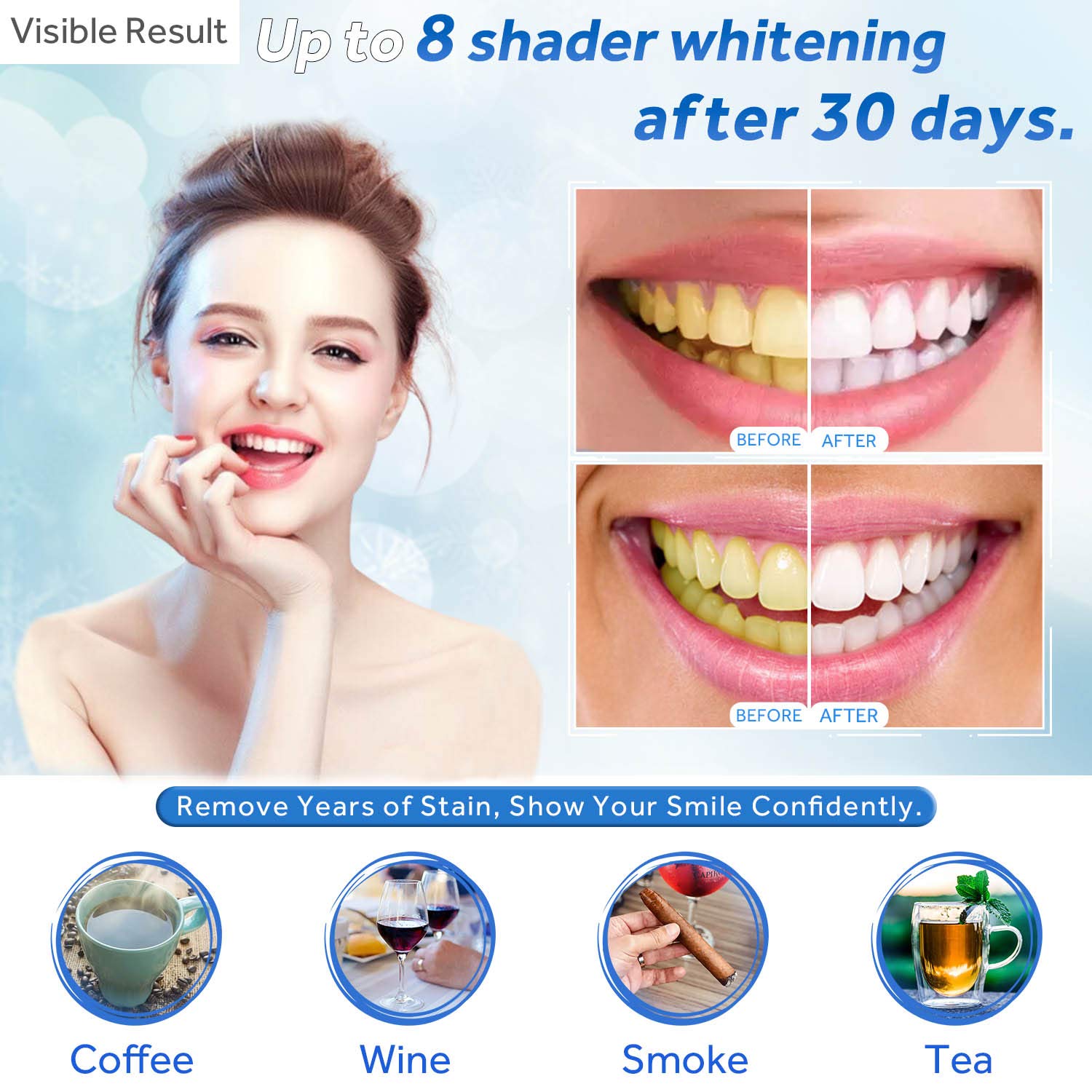 Teeth Whitening Gel Refill Syr - Teeth Whitening From Home 评论和价格