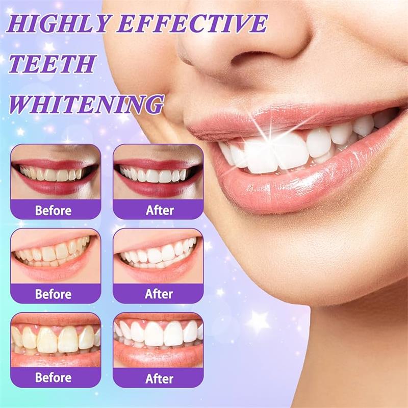 9D Purple Teeth Whitening Toot - Teeth Whitening Naturally 评论和价格