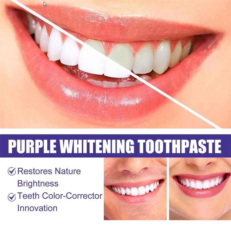 9D Purple Teeth Whitening Toot - Teeth Whitening Naturally 评论和价格